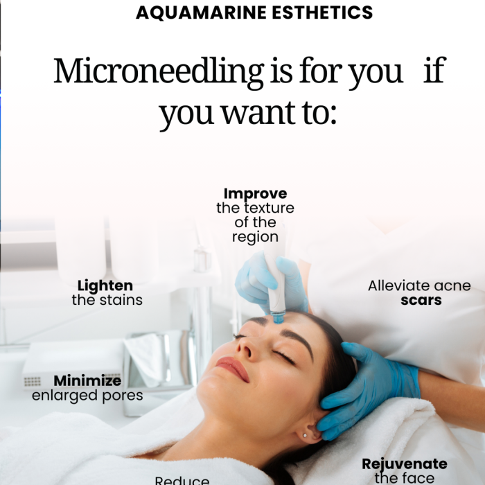 Microagulhamento estética benefícios minimalista branco instagram post